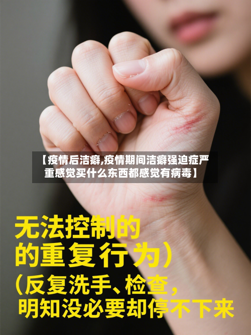 【疫情后洁癖,疫情期间洁癖强迫症严重感觉买什么东西都感觉有病毒】-第2张图片