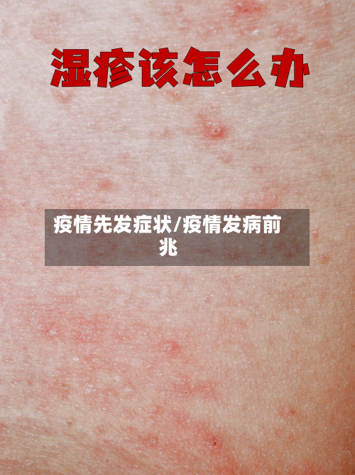疫情先发症状/疫情发病前兆-第2张图片