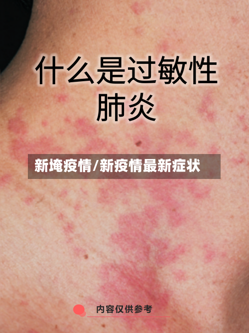 新埯疫情/新疫情最新症状