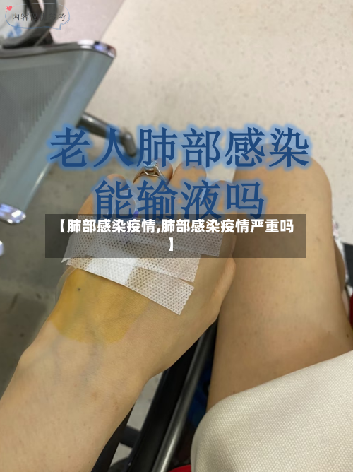 【肺部感染疫情,肺部感染疫情严重吗】-第2张图片