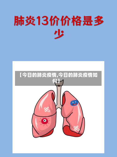 【今日的肺炎疫情,今日的肺炎疫情如何】-第3张图片