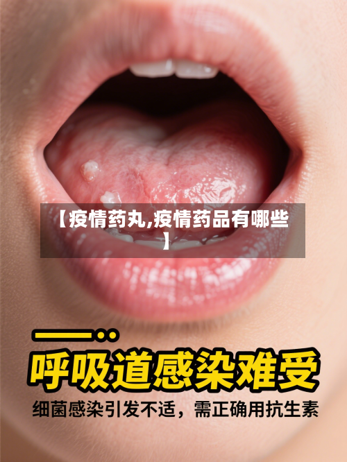 【疫情药丸,疫情药品有哪些】