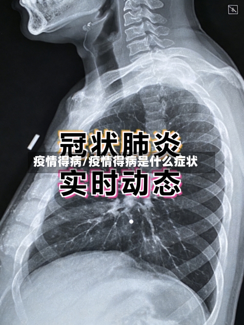 疫情得病/疫情得病是什么症状-第2张图片