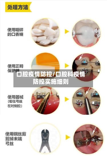 口腔疫情防控/口腔科疫情防控实施细则