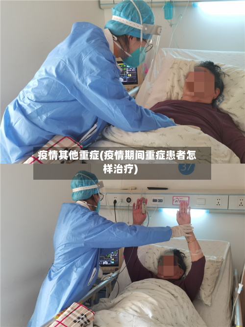 疫情其他重症(疫情期间重症患者怎样治疗)