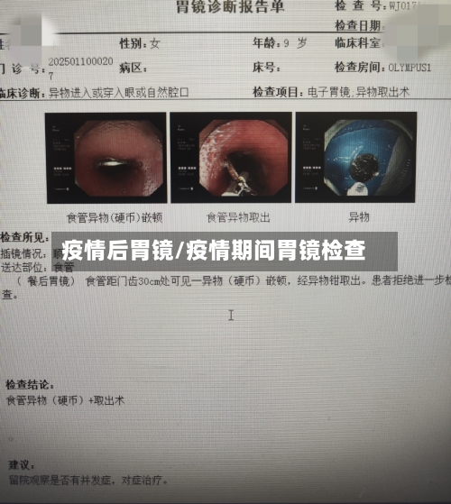 疫情后胃镜/疫情期间胃镜检查