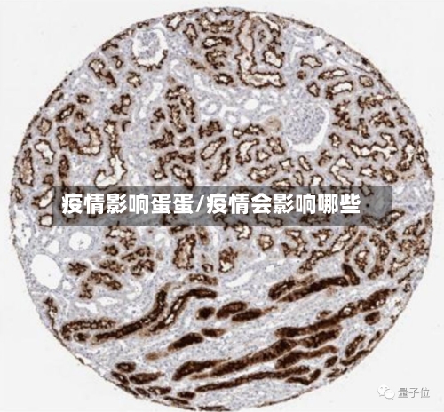 疫情影响蛋蛋/疫情会影响哪些