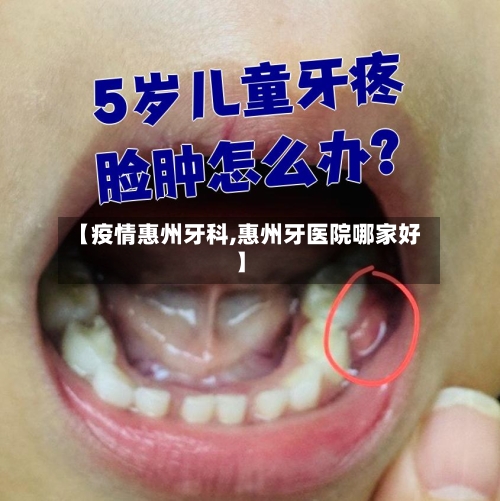 【疫情惠州牙科,惠州牙医院哪家好】-第2张图片