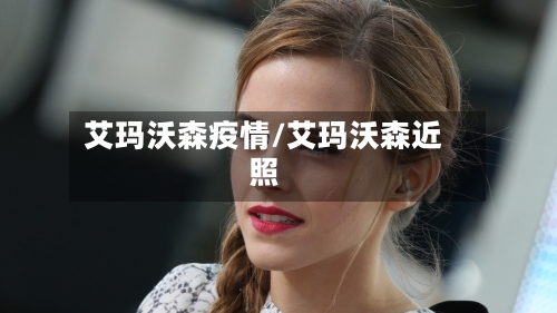 艾玛沃森疫情/艾玛沃森近照
