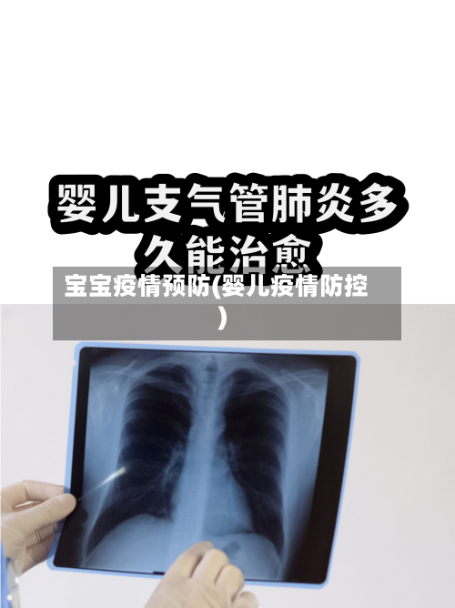 宝宝疫情预防(婴儿疫情防控)-第3张图片