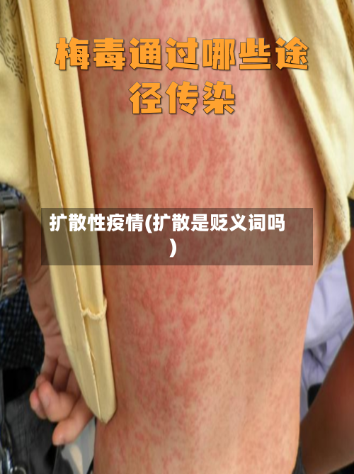 扩散性疫情(扩散是贬义词吗)-第2张图片