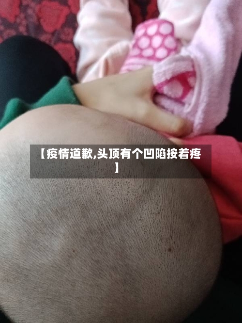 【疫情道歉,头顶有个凹陷按着疼】-第2张图片