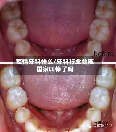 疫情牙科什么/牙科行业要被国家叫停了吗-第2张图片