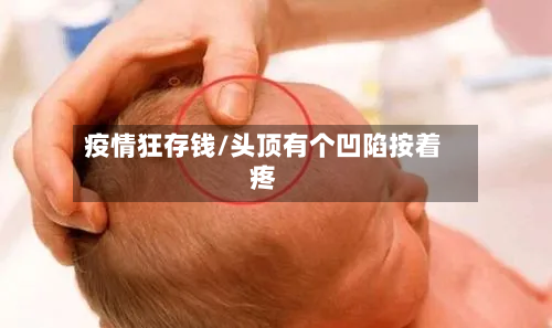 疫情狂存钱/头顶有个凹陷按着疼