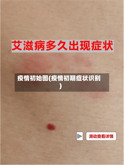 疫情初始图(疫情初期症状识别)-第2张图片
