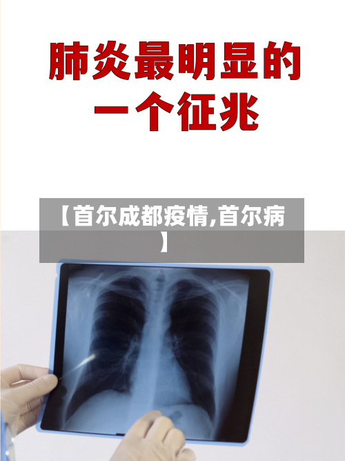 【首尔成都疫情,首尔病】