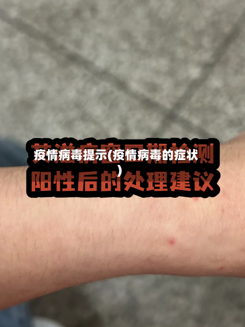 疫情病毒提示(疫情病毒的症状)