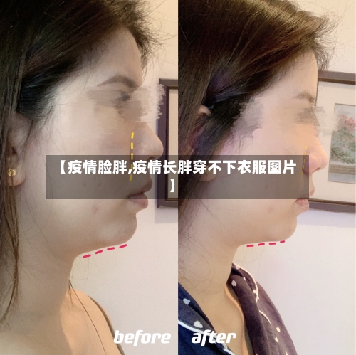 【疫情脸胖,疫情长胖穿不下衣服图片】